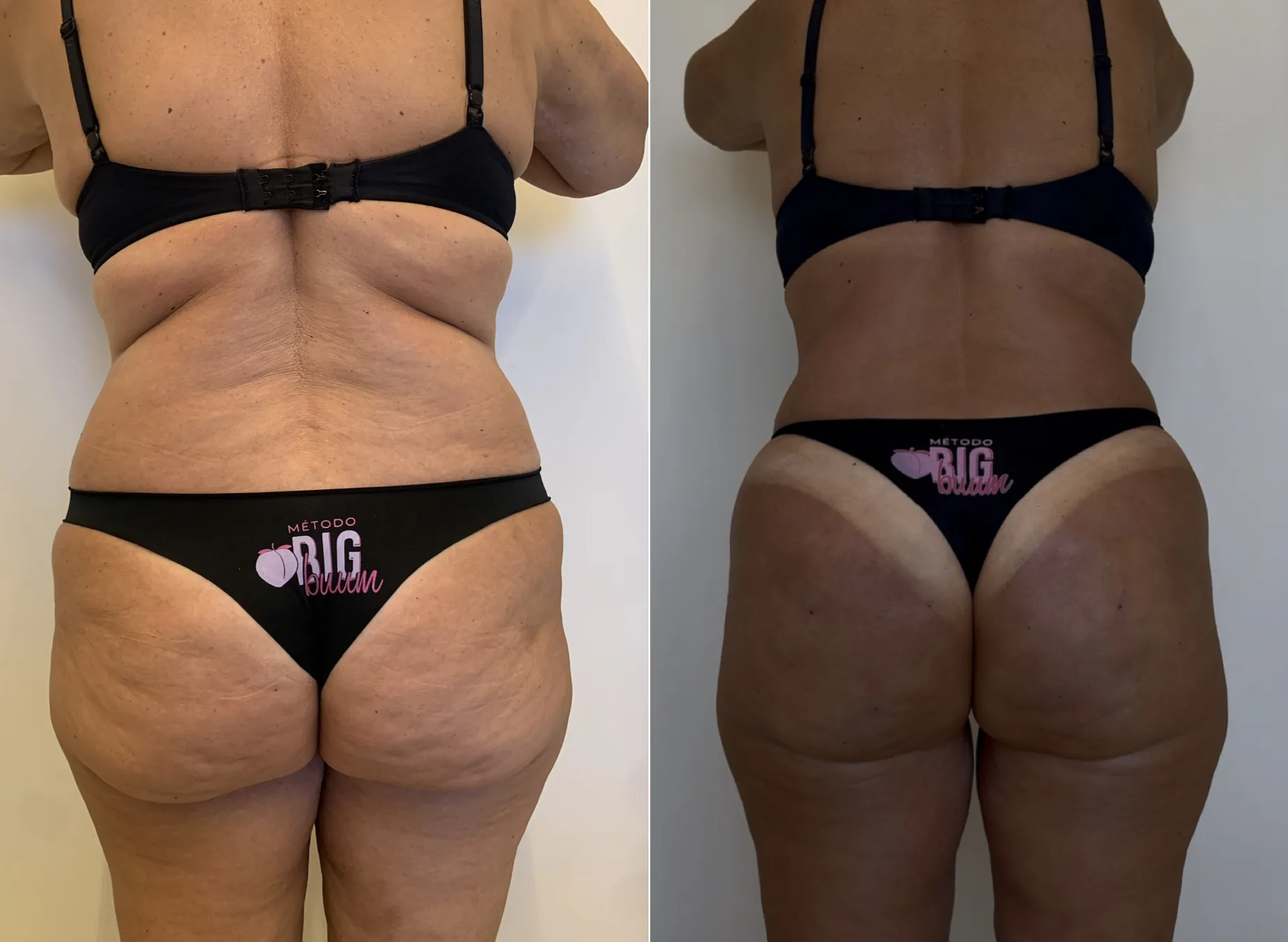 Antes e depois 3